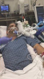 Gabey Abikzer in the period following the accident in which he lost both legs