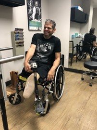 Gabey Abikzer during rehabilitation after losing both legs