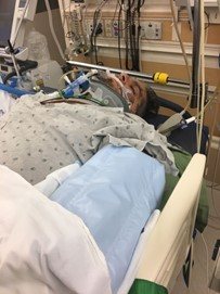 Gabey Abikzer in the period following the accident in which he lost both legs