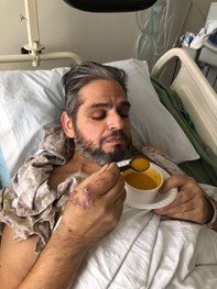 Gabey Abikzer in the period following the accident in which he lost both legs